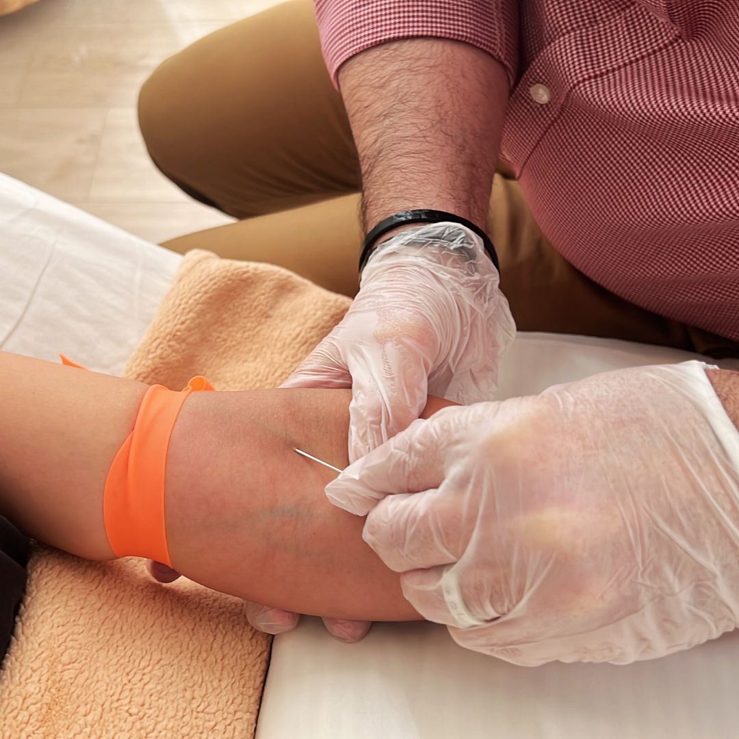 Naturopath Docotor inserting iv for vitamin therapy in Marpole Vancouver